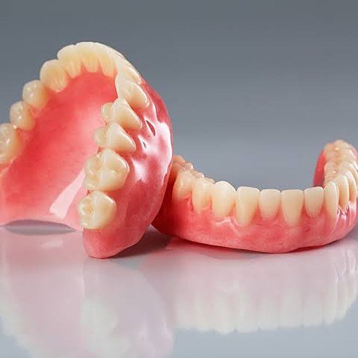A denture that will not stay put treated at Carat Smiles, Greater Kailash