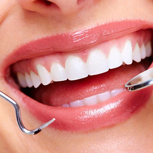Sensitivity to cold or sweet treated at Carat Smiles, Greater Kailash