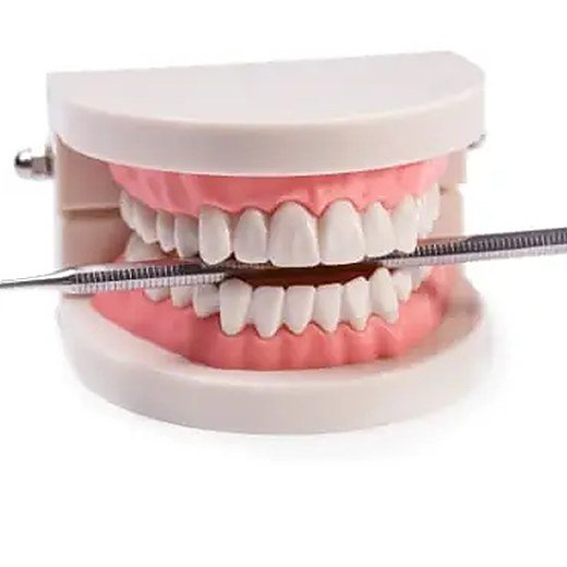 Teeth worn short and flat treated at Carat Smiles, Greater Kailash