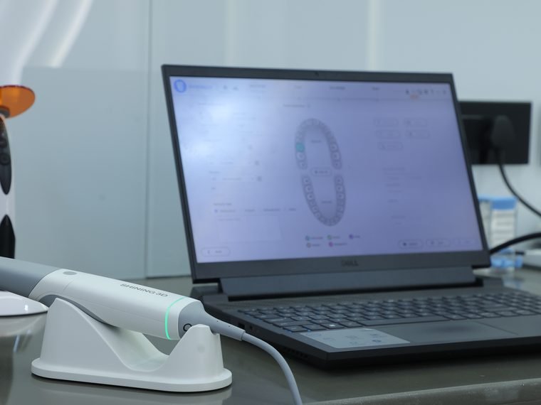 CAD/CAM smile design at Carat Smiles dental clinic, Greater Kailash