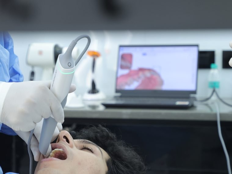 Digital impressions at Carat Smiles dental clinic, Greater Kailash