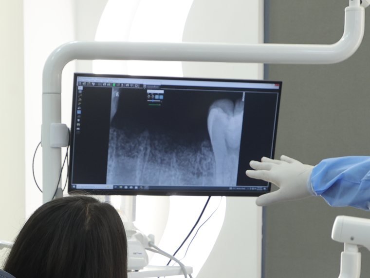 Digital radiography at Carat Smiles dental clinic, Greater Kailash