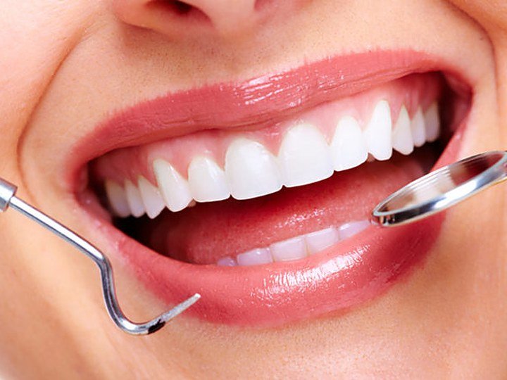 Cosmetic Dentistry at Carat Smiles, Greater Kailash 1, New Delhi