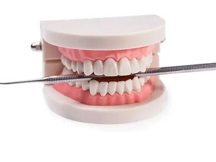 Full Mouth Rehabilitation at Carat Smiles, Greater Kailash 1, New Delhi